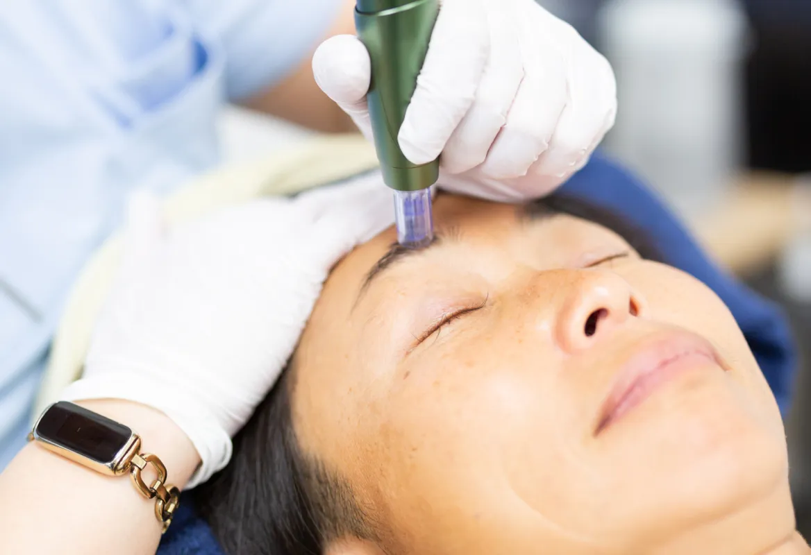 まつ毛への育毛サポート施術